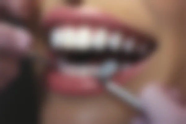 牙齿出现问题是否需要进行根管治疗？根管治疗的必要性分析与探讨