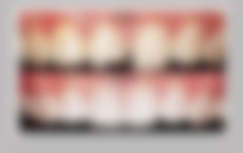 成都友谊医院整形美容中 心疤痕科优势