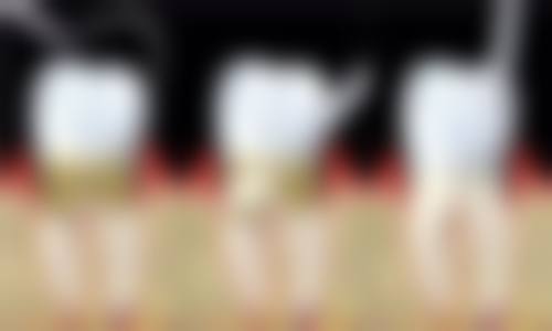 广州高尚医学美容中心是不是正规医院？是正规的，资质靠谱项目多医生经验也丰富！ 