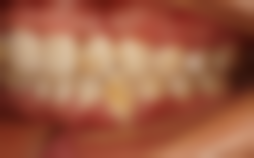 广州高尚医学美容中 心的丰富特色项目