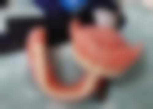 上海首尔丽格医疗美容医院坑不坑？实际体验揭秘，技术靠谱服务好不算坑！ 