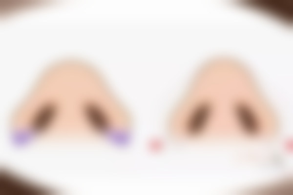 北京荔颜荔禾医疗美容怎么样?私立正规资质/谷廷敏侯亦康王民杰技术强服务好