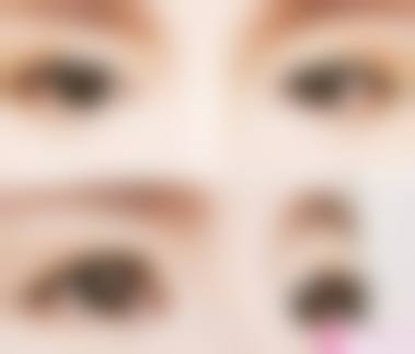 广州米伦医疗美容门诊部口碑评价好不好？顾客亲测技术靠谱、服务贴心，值得一去！ 