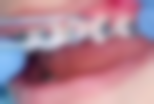 上海首尔丽格医疗美容医院：性价比分析，让你消费明明白白