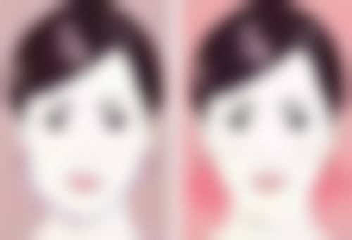 成都素美李建刚无痕筋膜提升3.0效果大揭秘