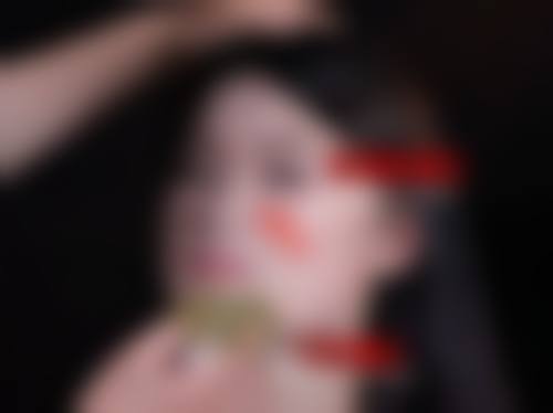 孙洪香医生简介做手术价格