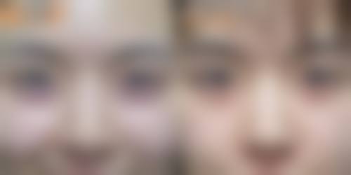 朴智慧医生简介做手术价格