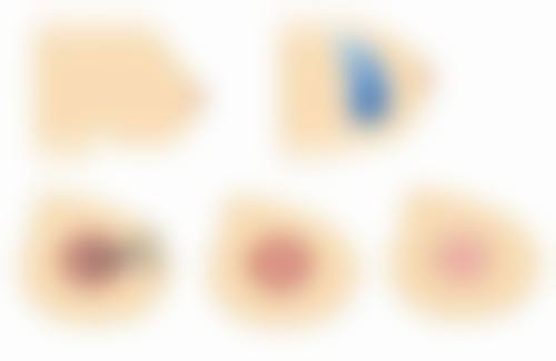 刘金虎医生简介怎么挂号