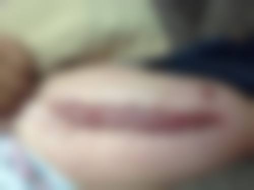 深圳吴玮综合门诊部医疗美容科怎么样