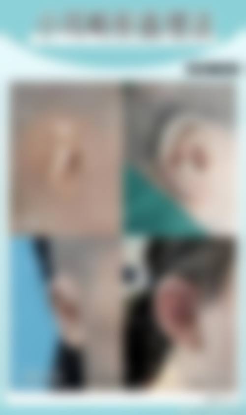 张炜强医生简介做手术价格