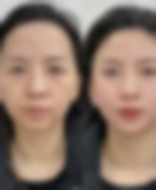 姜民赫医生怎么挂号