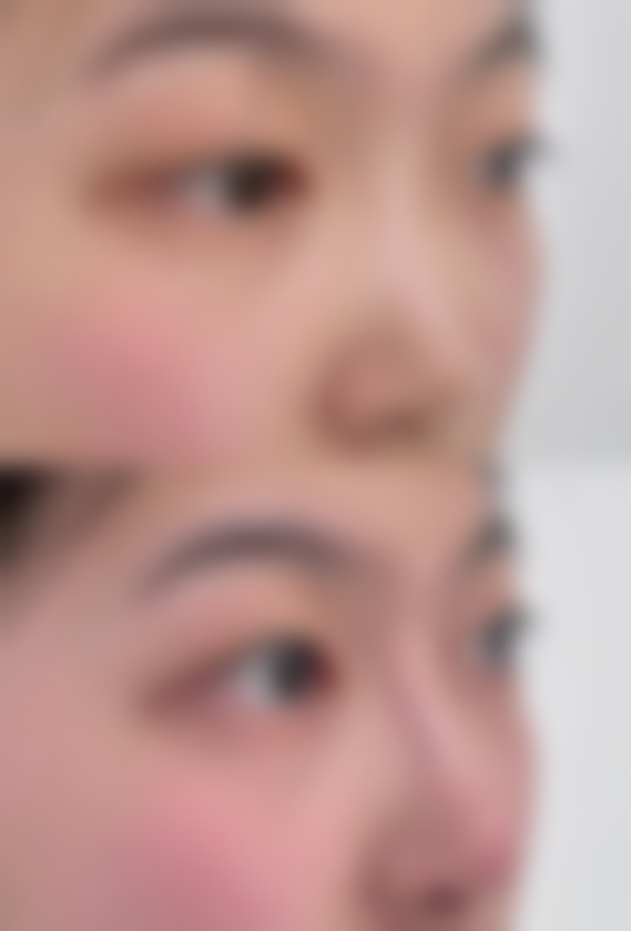 姜民赫医生顾客实例图片