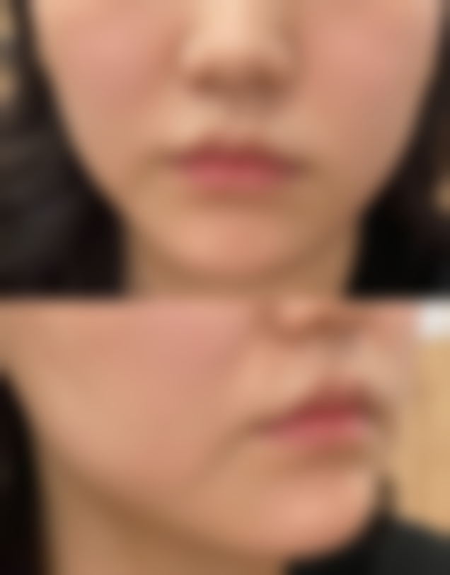 韩国Beauty＆Young整形外科医生简介