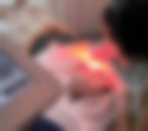 武警山东总队医院整形科价格表