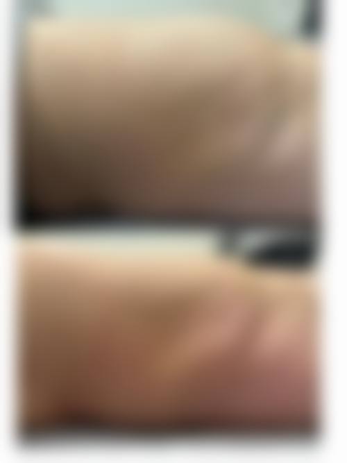 吉安艺美医疗整形美容医院怎么样——价格表