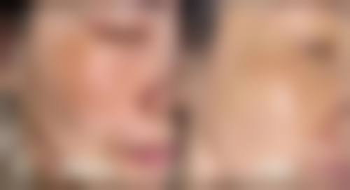 汕头澄海港立医院医疗美容科口碑评价如何