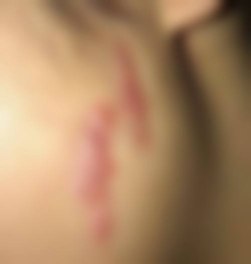 吉安艺美医疗整形美容医院怎么样——口碑评价