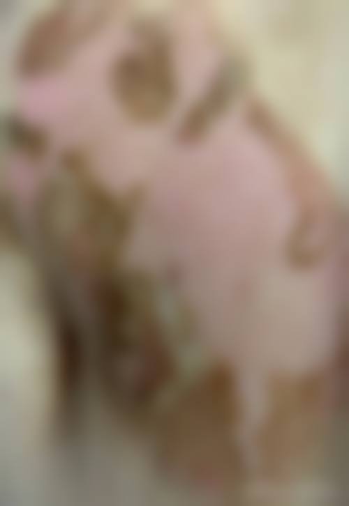 成都高新美瑞紫荆皮肤医疗美容医院真实患者口碑评价