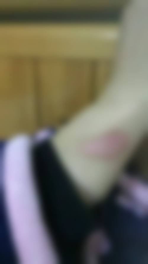 幸皮肤科诊所怎么样，可靠吗