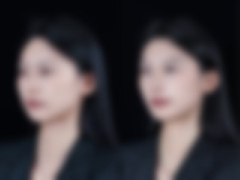 上海博馨恩整形医疗美容门诊部顾客实例