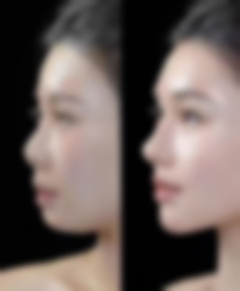 西安莲湖瑞丽医院医学美容项目特色