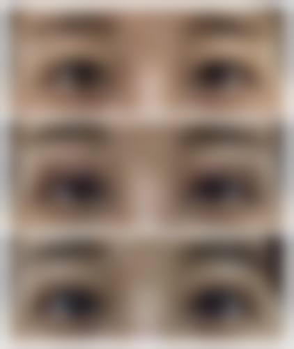 福州市晋安区韩尔医疗美容门诊部价格表