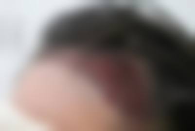 熙朵植发连锁·大兴院部口碑好不好