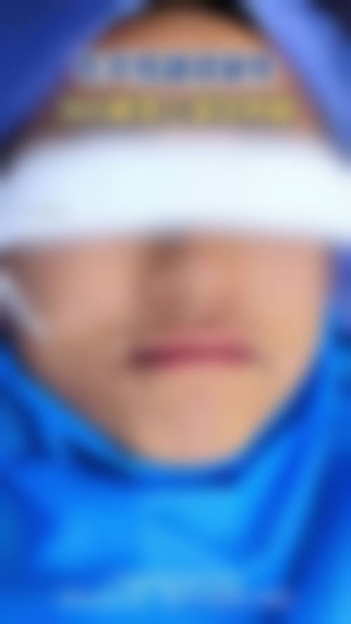 郑州优恩美容医院项目特色