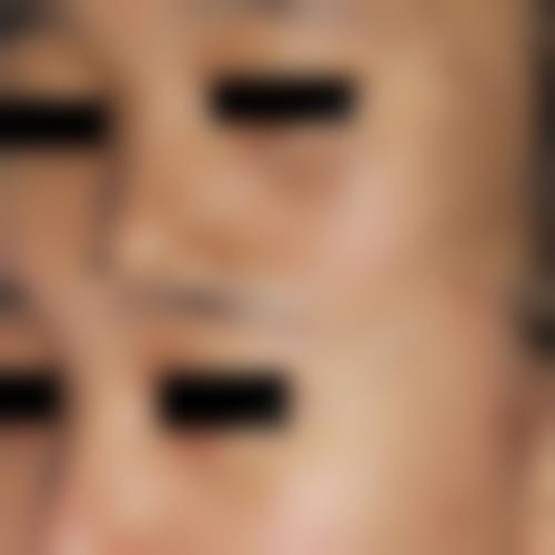 呼和浩特市第一医院医疗美容科项目特色