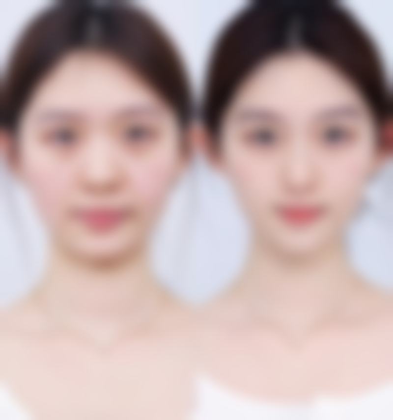 广州胜康医院医疗美容科价格表