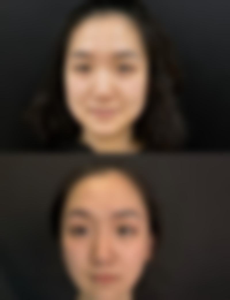 南宁连美整形抖音团购活动及价格表