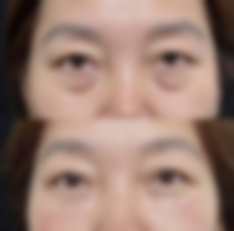 南宁连美整形正规吗？有哪些优势项目