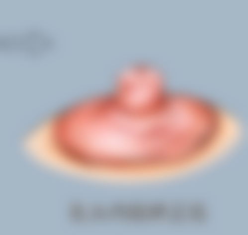 脸部抽脂后多久可以见成效：小V脸的蜕变之旅