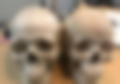 打完瘦脸针做美容时间间隔的重要性