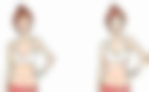 外切眼袋冰敷是起什么作用——改善淤青