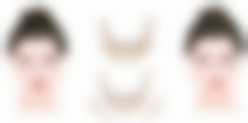 告别“通天鼻”，重获精致美鼻