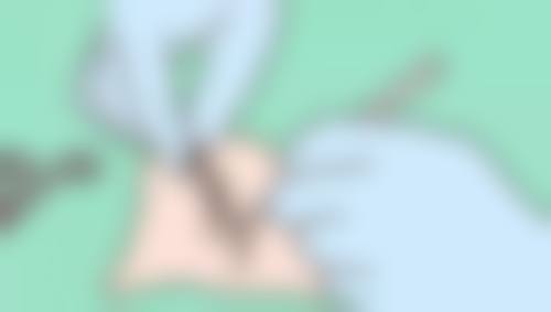 四川成都美容整形医院私密科怎么样之价格表