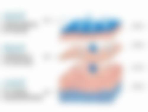 外切眼袋冰敷是起什么作用——减少出血