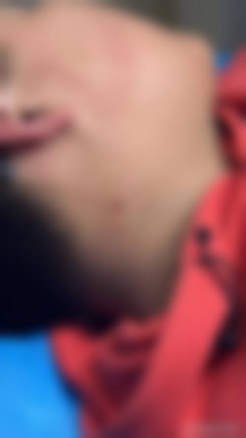 三、山东临沂媄媄整形医院怎么样之口碑评价