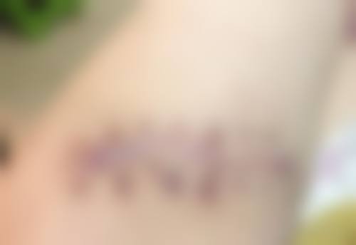 广州禾丽医疗美容门诊部更擅长什么