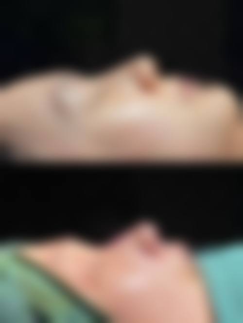 新乡奕诺美医疗美容医院——个性化方案与自然美观