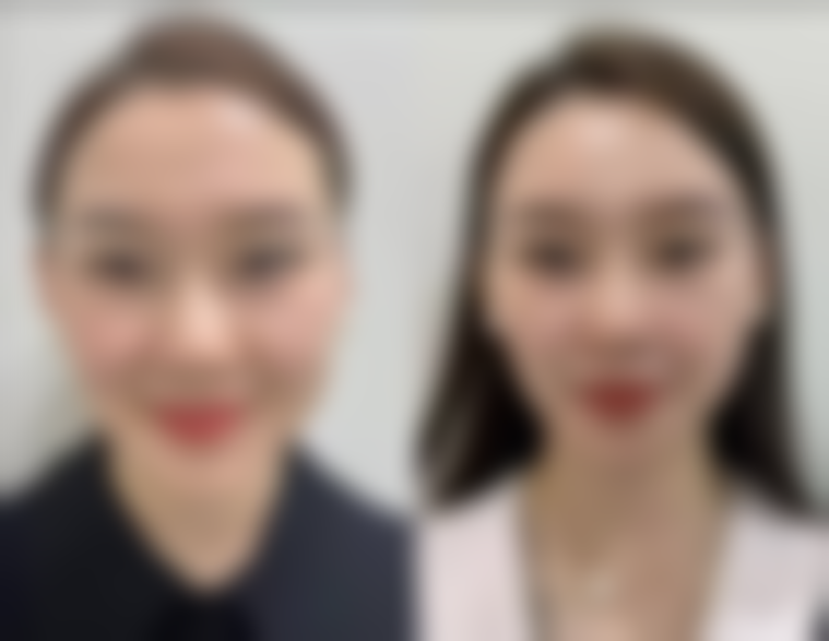 祛痣疤痕多久可以恢复？晋圣阳、王雄解析体质及术后护理要点