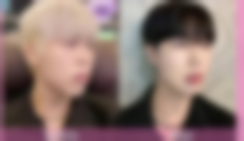 涂抹丰太阳穴适合所有人吗？理性选择变得更美方式