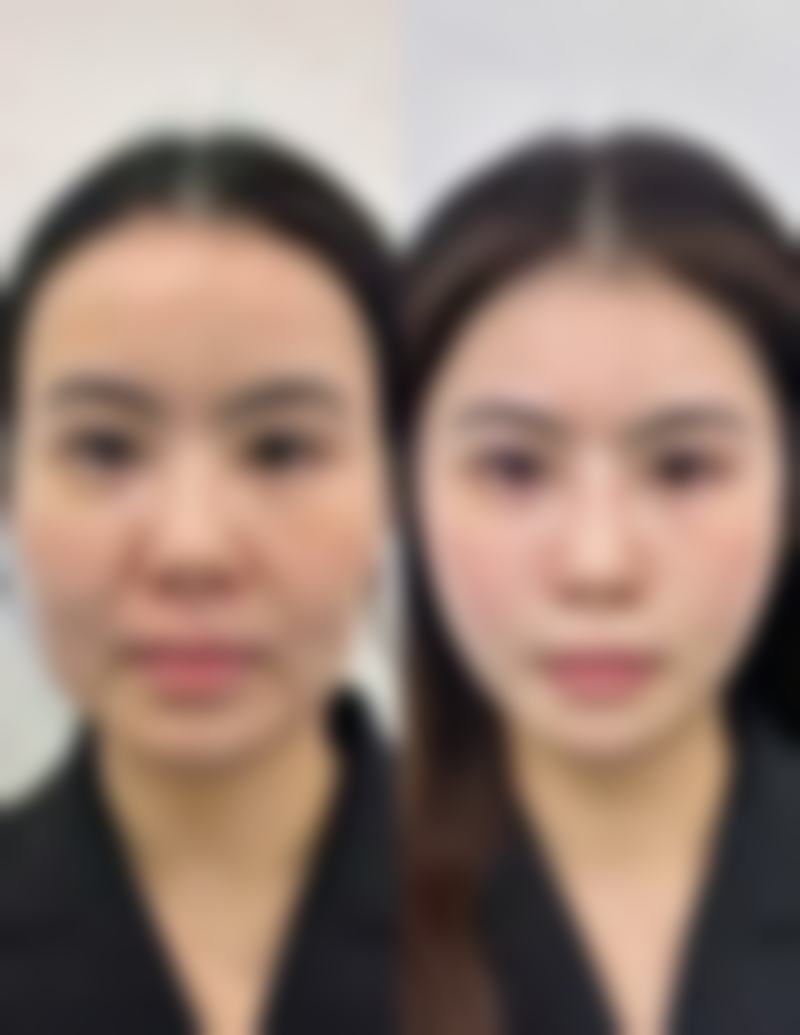 总结与贴心建议