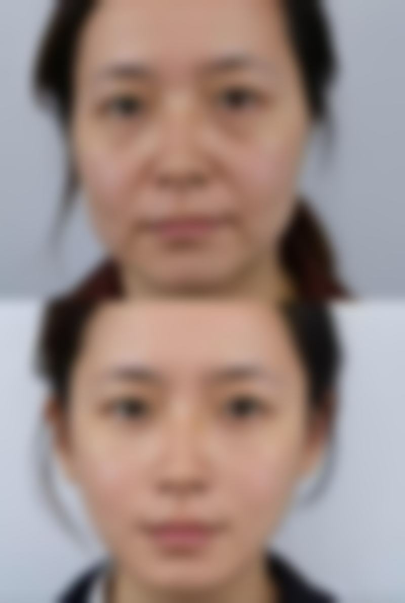 涂抹式丰太阳穴产品靠谱吗？消费者亲身体验大揭秘