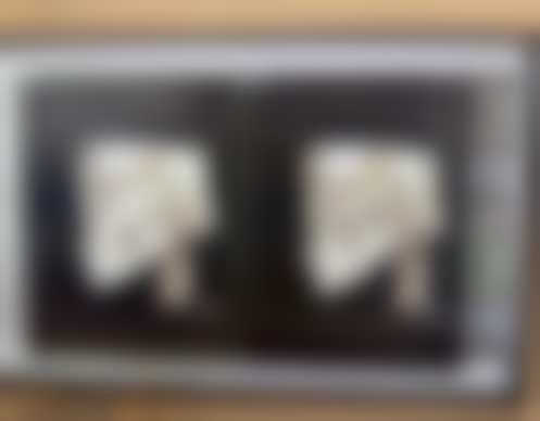 告别疤痕，重拾自信