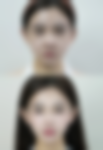 打完瘦脸针做美容会反弹吗