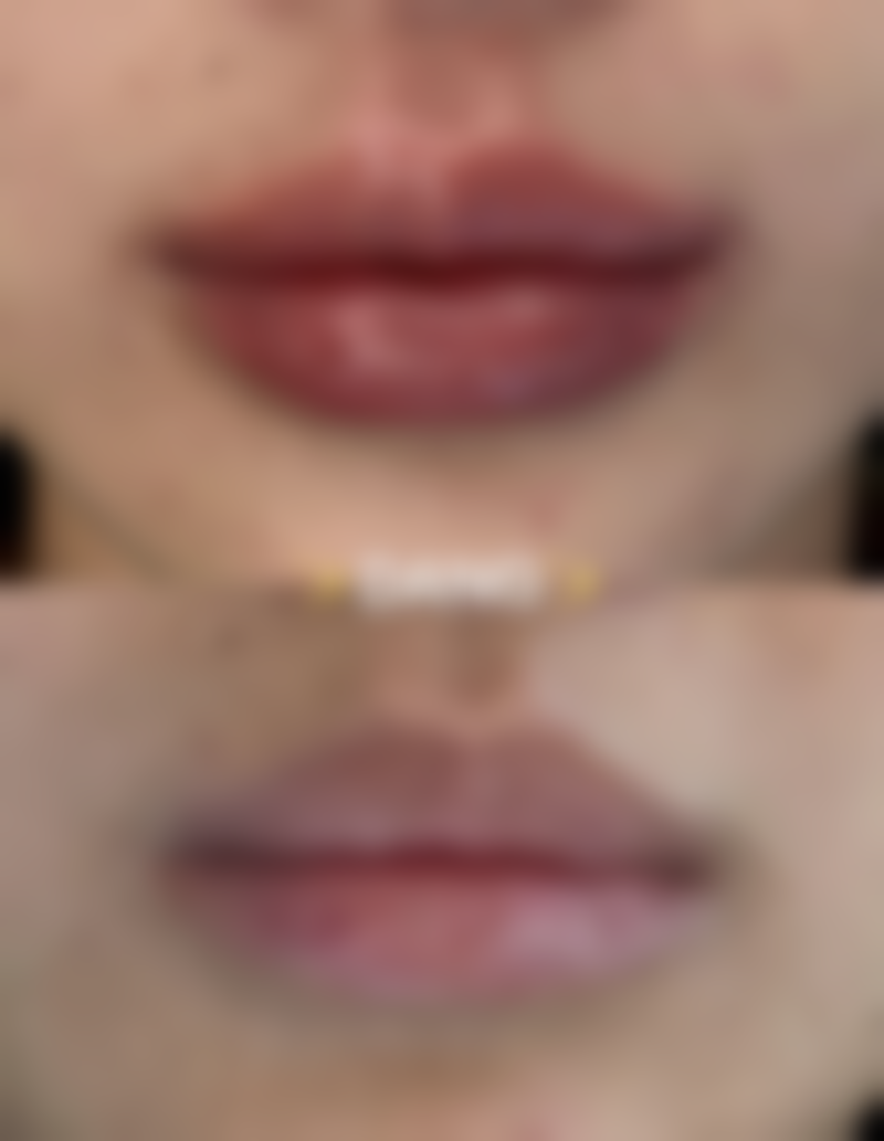 四川成都美容整形医院私密科怎么样之项目特色