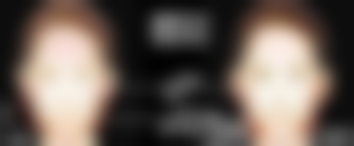 打瘦脸针脸肿的原因是什么