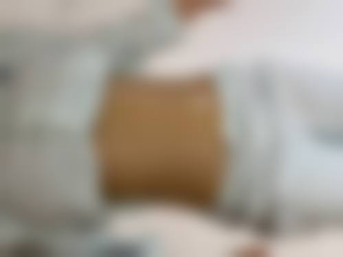 臀部吸脂减肥疼吗——李海东医生所在医院